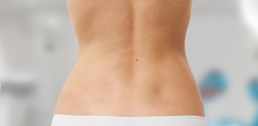 Zones de liposuccion : taille et hanches
